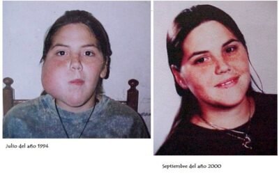 Testimonio de Sarcoma de Ewing