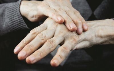 Parkinson